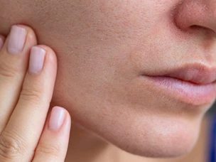 Rotina de skincare pele seca