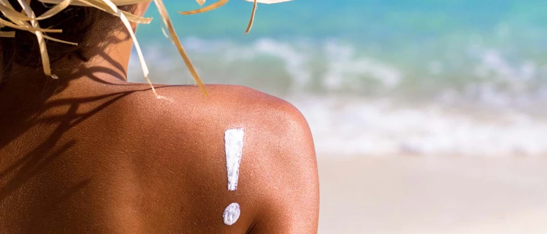 Como Curar um Escaldão Solar Rapidamente